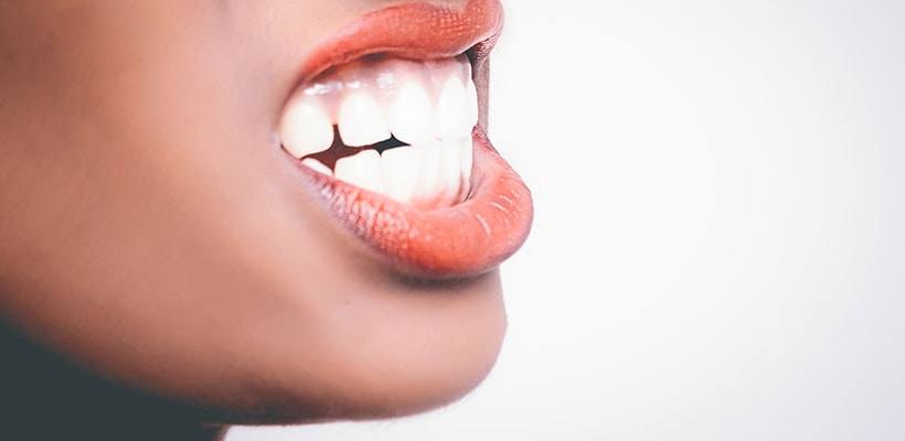 Wisdom Teeth 101: Why Do Wisdom Teeth Get Removed? | Whitehorse Dental
