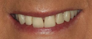 Dentist in Blackburn - Whitehorse Dental