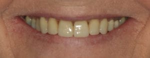 Smile Gallery in Blackburn - Whitehorse Dental