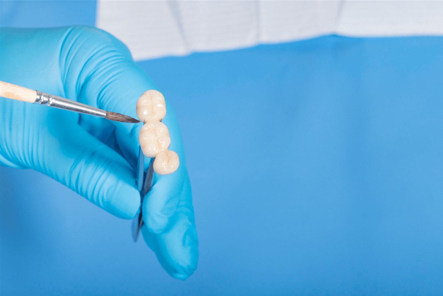 The Difference Between a Dental Crown and Bridge