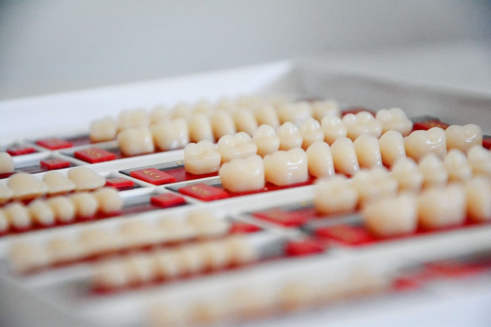 3 Ways Porcelain Veneers Can Improve Your Teeth Appearance