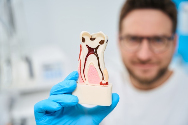 Man dentist in uniform holding and showing 3d model of tooth