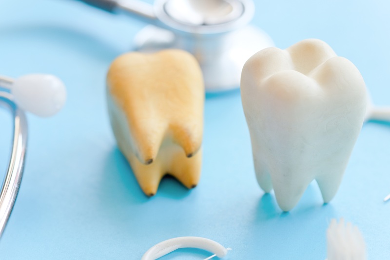 A teeth model for molar