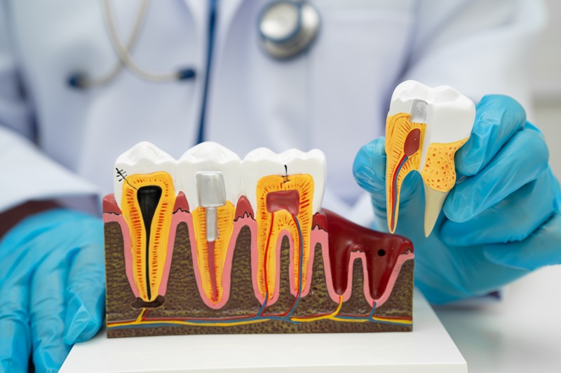 Local Dentist Blackburn - Whitehorse Dental