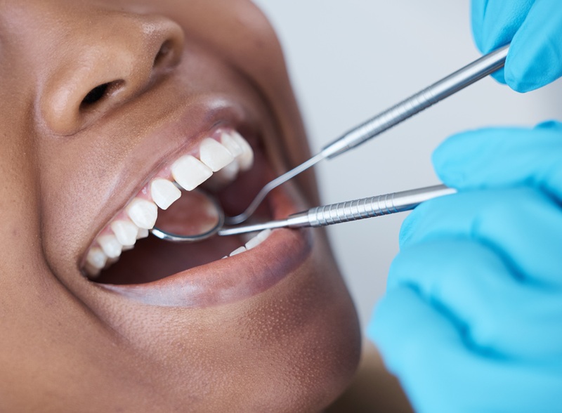 Checkup, mouth and woman at the dentist for dental care, healthcare and search for cavities. Mirror.
