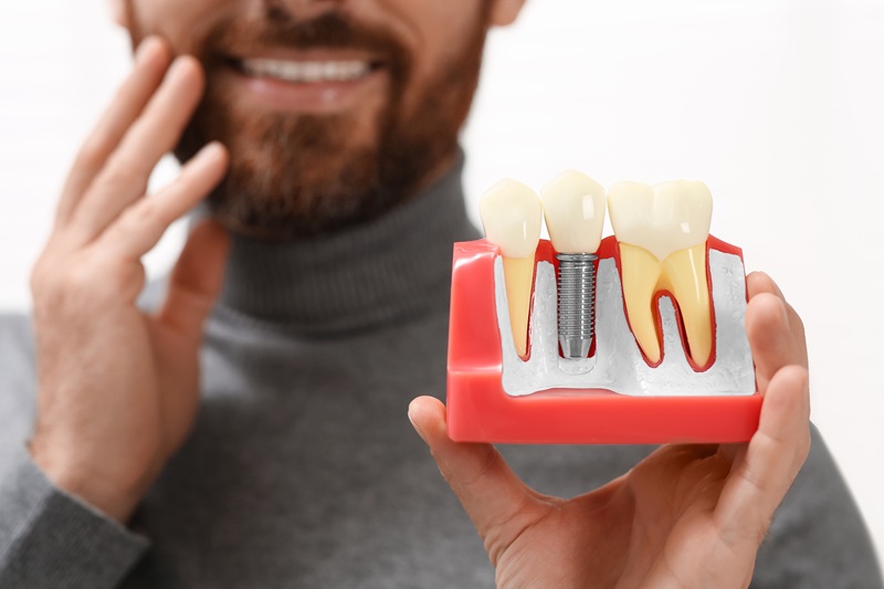 Man holding educational model of dental implant on blurred background, closeup